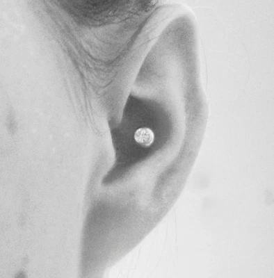 Perno caracola bola gema esterilizado de 6 mm con pernos de acero quirúrgico de 6, 8 y 10 mm. Foto 1 de 4