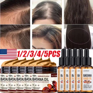 5/3PCS Batana Oil Serum for Hair Growth, Batana Oil Essence, Repair Damaged Hair - Picture 1 of 49