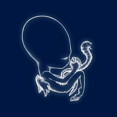 Sigur Rós – Ágætis Byrjun CD | Post-Rock Classic | Preowned Tested Gr Foto 1 de 2