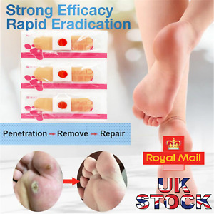 NEW STYLE Foot Corn Remover Pads Plantar Wart Thorn Plaster Patch Callus Removal