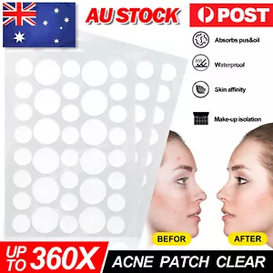Skin Tag Remover Acne Pimple Patch Removal Facial Care Spot Plaster AU STOCK - Picture 1 of 20