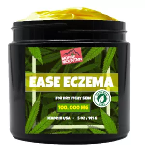 Psoriasis & Eczema Natural Treatment | for face and hands - Picture 1 of 7