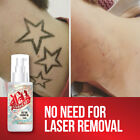 INKED UP TATTOO FADING OIL ? NO NEED LASER REMOVE TATTOO FADE AWAY DARK INK 
