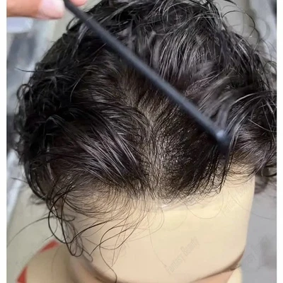 Undetectable 0.02mm Utral Thin Skin Base Men's Hairpiece Real Human Hair toupee - Image 1 of 4