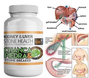 Liver and Kidney Cleanse, Liver Detox, Kidney Cleanse chanca piedra guisazo 