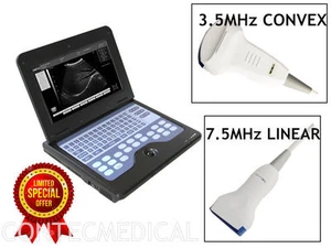 Full Digital-Ultraschall-Scanner-Maschine CMS600P2+3,5 Convex 7.5 Linear 2 Sonde - Picture 1 of 12