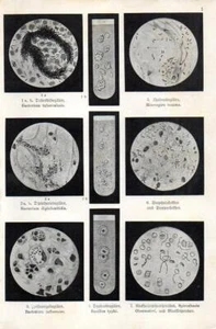 1909 WILLKOMM CHROMO bacteria: diphtheria, cholera, flu, typhus, tuberculosis - Picture 1 of 3