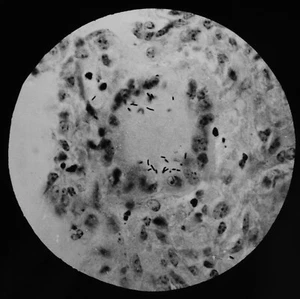 ANTIGUA Linterna Mágica Diapositiva BACTERIA Nº1? FOTO MICROSCOPIO C1910 - Imagen 1 de 3