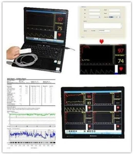 Oxímetro de pulso basado en PC, monitor de oxígeno SPO2 + software + USB, CMS-P, NUEVO - Imagen 1 de 4