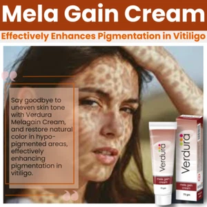 Mela Gain Cream Repigmentation White Marks Vitiliginous Skin Vitiligo Treatment - Picture 1 of 9