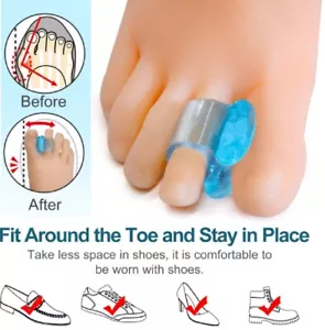1‑Pair Silicone Gel Bunion Corrector & Toe Separator – Orthotic Pain Relief - Picture 1 of 5