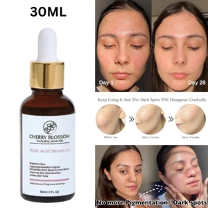 Natural 2%Kojic Acid Serum for Pigmentation and Dark Spots Skin Brightening 30ML - Picture 1 of 5