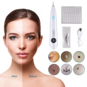9 Level Electric Laser Plasma Pen Handheld Tattoo Skin Removal Salon Beauty Tool - Picture 1 of 15