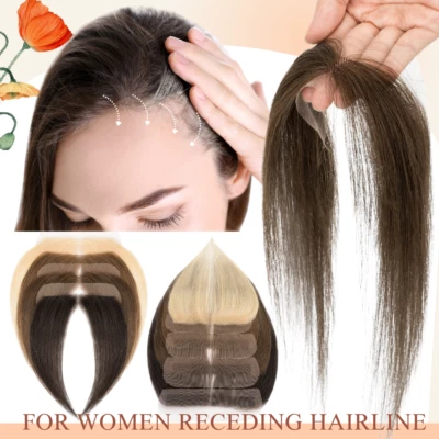 Full Lace Cover-up Hairpiece Remy Human Hair Front Hairline Patch Topper Toupee - Image 1 of 4