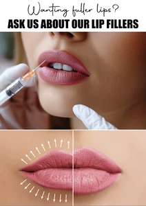 Rellenos Labiales Botox Disponible Aquí Póster Laminado Aviso Letrero Salón de Negocios - Imagen 1 de 1