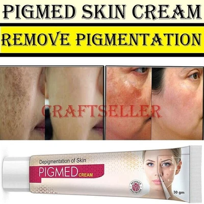 Pigmentation Acne Scars Dark Spots Pimple Marks Blemish Ayurvedic SkinCream 30gm - Image 1 of 4