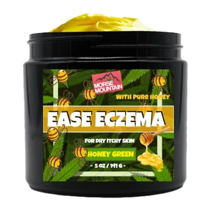 Eczema / Psoriasis Honey Ointment Cream Natural Dermatitis Treatment - Picture 1 of 9