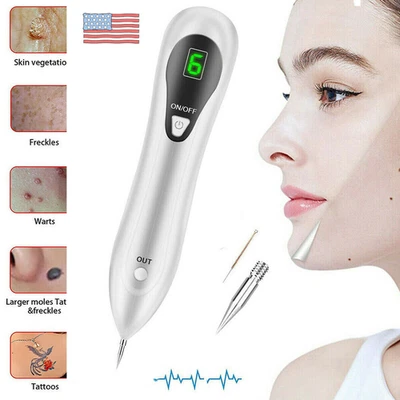 Electric Laser Plasma Pen Mole Removal Dark Spot Remover Skin Wart Tag Tattoo - Image 1 of 4