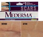 Genuine New Mederma Scar Gel 20G For Injury Burns Acne And Stetch Marks 20Gm