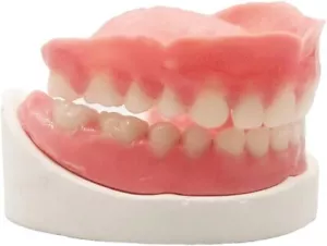 Adjustable DIY Denture Set – Full Fake Teeth & Gypsum Model for Easy Fit - Picture 1 of 8