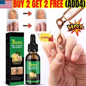 7 Days Nail Fungus Treatment All Natural Formula Gingers Nail Toenail Care 30ml~ - Picture 1 of 7