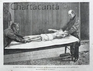 1875 Incisione PROFESSOR PACINI FIRENZE RESPIRAZIONE ARTIFICIALE - Imagen 1 de 1