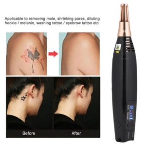 Tattoo Laser Scar Spot Removal Pen Mole Remove Picosecond Blue Light Therapy UK - Picture 1 of 12