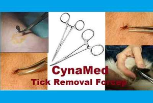 Plucker de eliminación de garrapatas - Herramienta de eliminación de garrapatas de la mejor calidad para humanos, perros, gatos. - Imagen 1 de 1