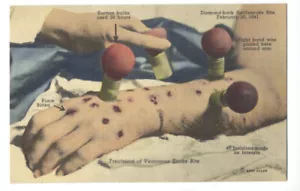 VENOMOUS RATTLESNAKE BITE Reptile Inst. SILVER SPRINGS FL Weird 1946 Linen RARE - Picture 1 of 2