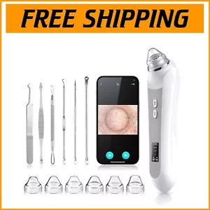 6 Suction Head Blackhead Remover Vacuum with Built-in HD Camera for Clear Skin - Picture 1 of 9