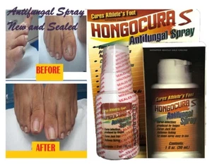 ANTI FUNGAL  SUPPORT EXTRA STRENGTH TOENAIL FUNGUS ATHLETES FOOT NAIL - Picture 1 of 4