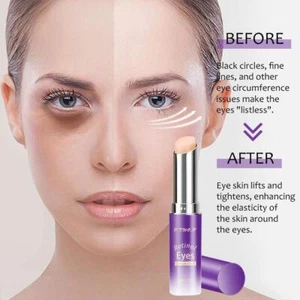 Retinol Eye Cream Stick Remover Dark Circles Bags Puffiness Moisturizing G3P2 - Picture 1 of 13