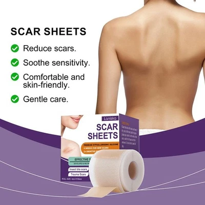 Silikon Narbenpflaster 4 x 150 cm Silikon Narbenpflaster Gesicht, für das K0... - Image 1 of 4