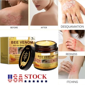 Bee Venom Skin Restoration Cream, Professional Bee Venom Skin Treatment Cream US - Picture 1 of 18
