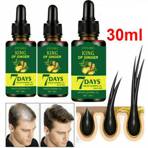 3Pcs 30ml Hair Growth Serum 7-Days Ginger Germinal Hairdressing Oil Anti-Loss