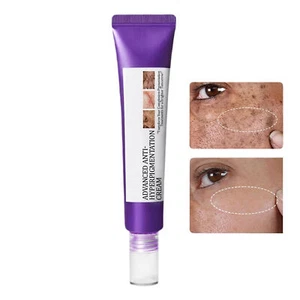 Hyperpigmentation Cream 20g Mild Face Moisturizer Skin Blemish Removal stylish - Foto 1 di 12