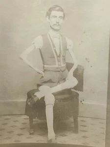 old photos of ugly people.freaks - Picture 1 of 4