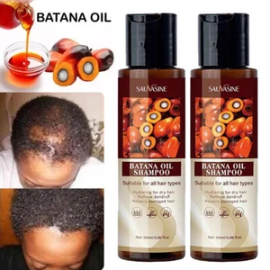2Pcs Batana Oil Shampoo For Hair Growth Healthier Thicker Fuller Anti Hair Loss - Picture 1 of 18