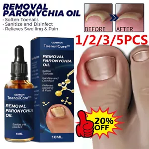 Aceite de alivio antiparoniquia 2023 Best German ToenailCare NailProp_ - Imagen 1 de 16