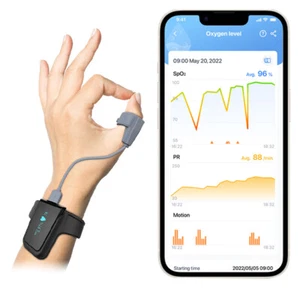 Oxímetro de pulso Checkme O2 Max para SpO2 y seguimiento continuo de la frecuencia cardíaca - Imagen 1 de 14