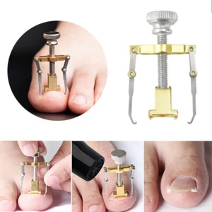 Kit de soporte para uñas encarnado cuidado profesional de uñas pedicura reparador - Imagen 1 de 11