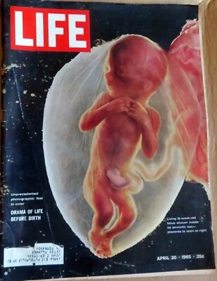 LIFE Magazine - Drama of Life Before Birth - April 30, 1965 - Image 1 of 2