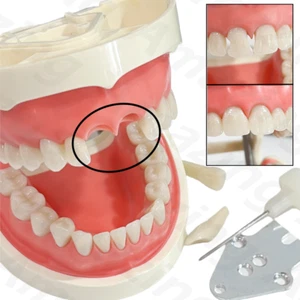 Dental Modelo BT Triángulo Negro Dientes Anteriores Entrenamiento Cierre Brecha Matrices Transparentes - Imagen 1 de 11