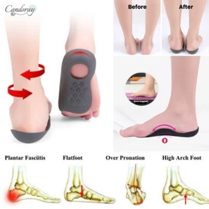 Foot Orthotic Corrective Arch Support Insole Pronation Supination O/X Type Legs - Picture 1 of 3