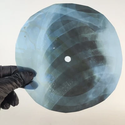 PINK FLOYD CANDY & CURRENT BUN X-Ray USSR Record Roentgen Bone Ribs Music Vinyl - image 1 of 2