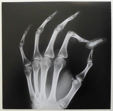 X-ray radiography-gherkin-pickle-test silver -