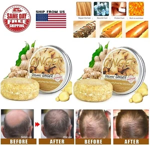 2×Ginger Hair Growth Shampoo Bar Soap hair Regrowth Anti Hair Loss damage repair - Picture 1 of 12