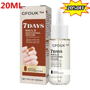GFONEU 7 Days Nail Growth and Strengthening Serum-20ML .NEU - Imagen 1 de 15