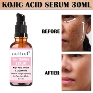 KOJIC ACID Skin Whitening Lightening Face Brightening Serum 1 oz/30ml - Picture 1 of 13