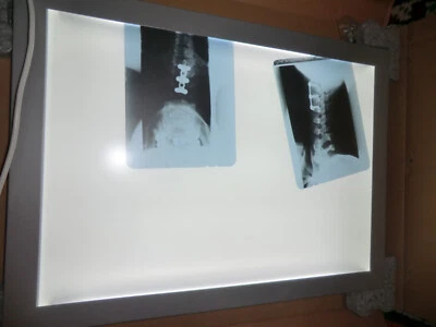 * Lumex LEUCHTRAHMEN * Glasrahmen beleuchtet *Leuchtreklame * made in Germany - Bild 1 von 4